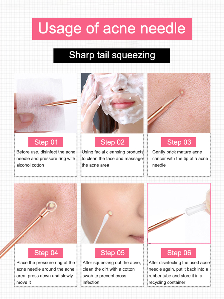 にきび除去剤にきび面皰抽出ツール傷白ニキビにきび除去のための - Luxury Skincare Acne のレビューと価格