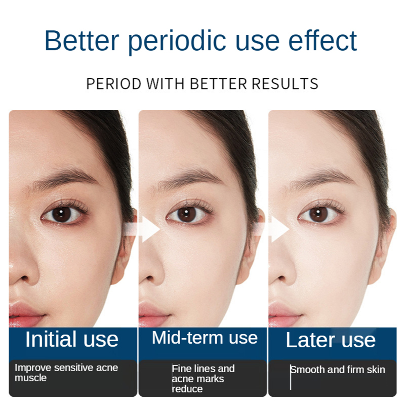 フェイシャルケアとクリーニングキット,フェイシャルケア,保湿 - Oligopeptide Wrinkle のレビューと価格