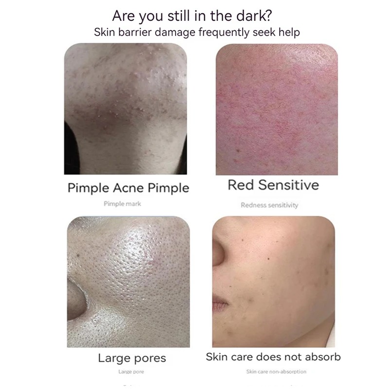 GHK-Cuブルーカッパーペプチドフリーズドライパウダーセッ - Oligopeptide Wrinkle のレビューと価格