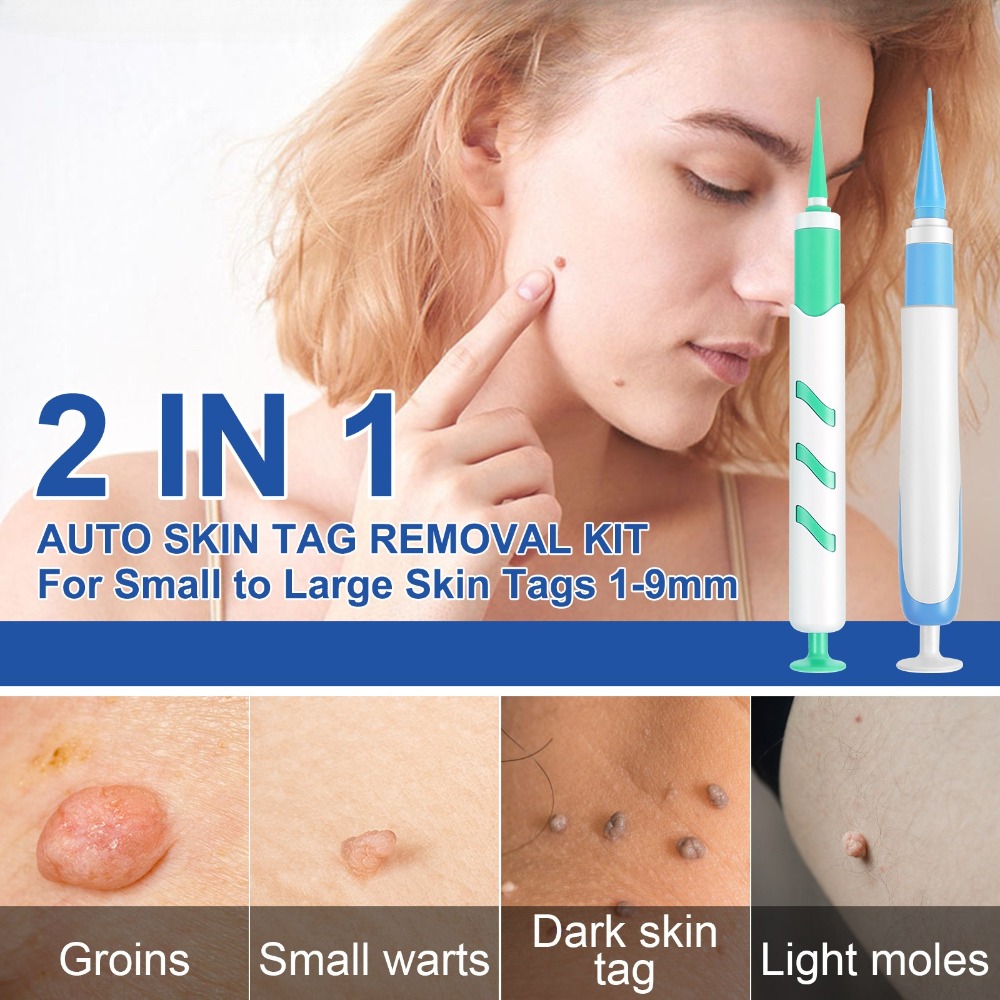 2-IN-1自動スキンタグ除去ツールキット 痛みのないほくろ - Luxury Skincare Acne のレビューと価格