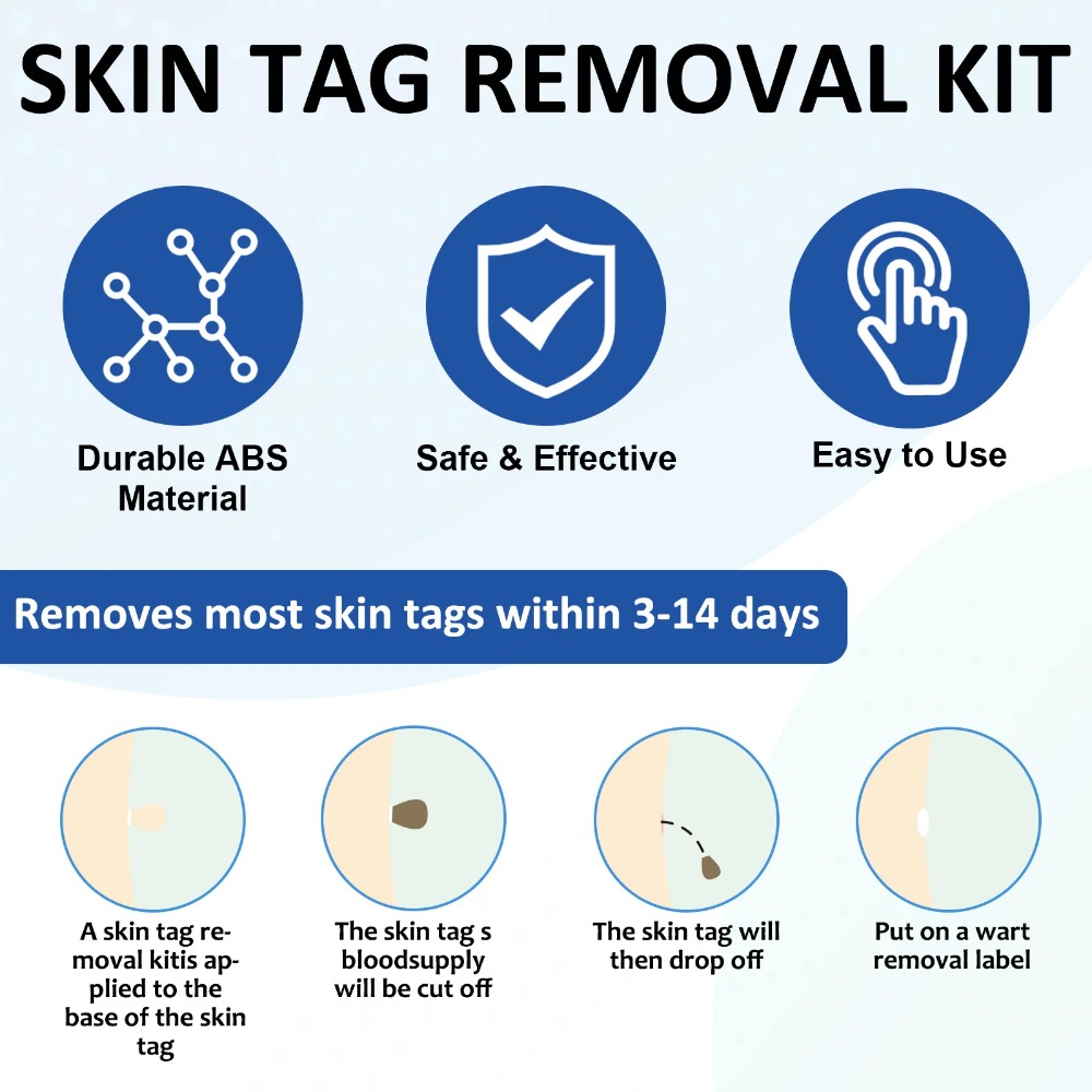 2-IN-1自動スキンタグ除去ツールキット 痛みのないほくろ - Luxury Skincare Acne のレビューと価格