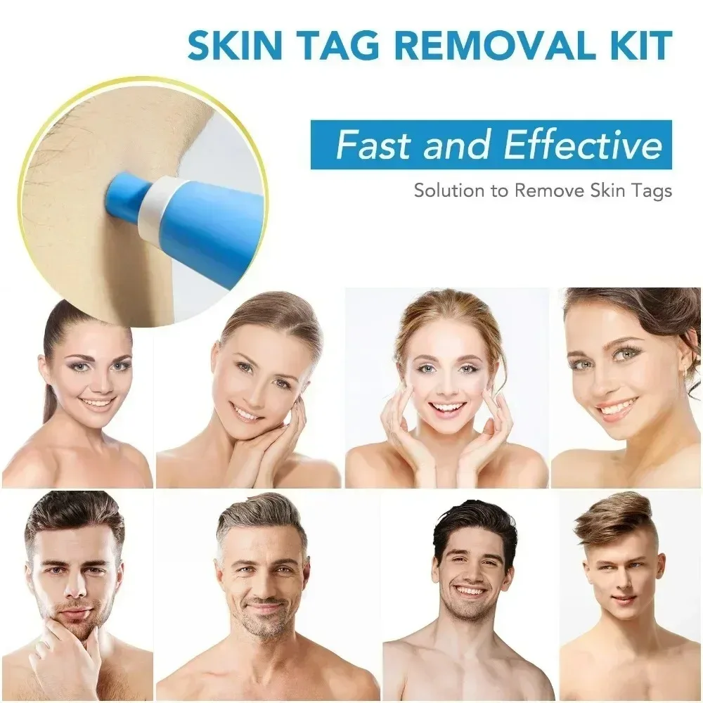にきびリムーバー 2 IN 1 自動マイクロスキンタグリムー - Luxury Skincare Acne のレビューと価格